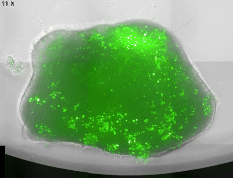 Organoid 2, raw imaging