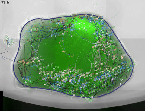 Organoid 2, AI-segmented