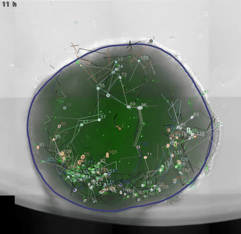 Organoid 3, AI-segmented